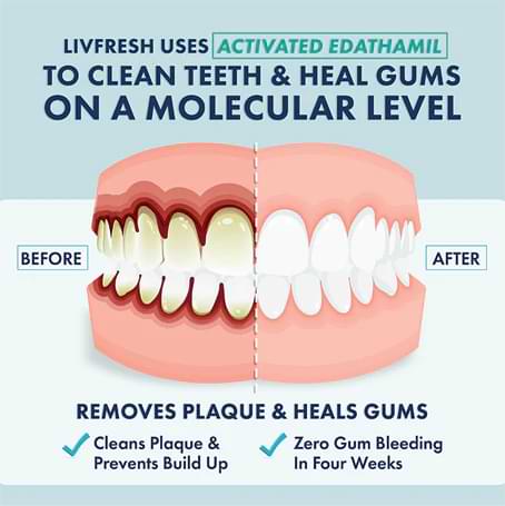 DentalGel LivFresh after use