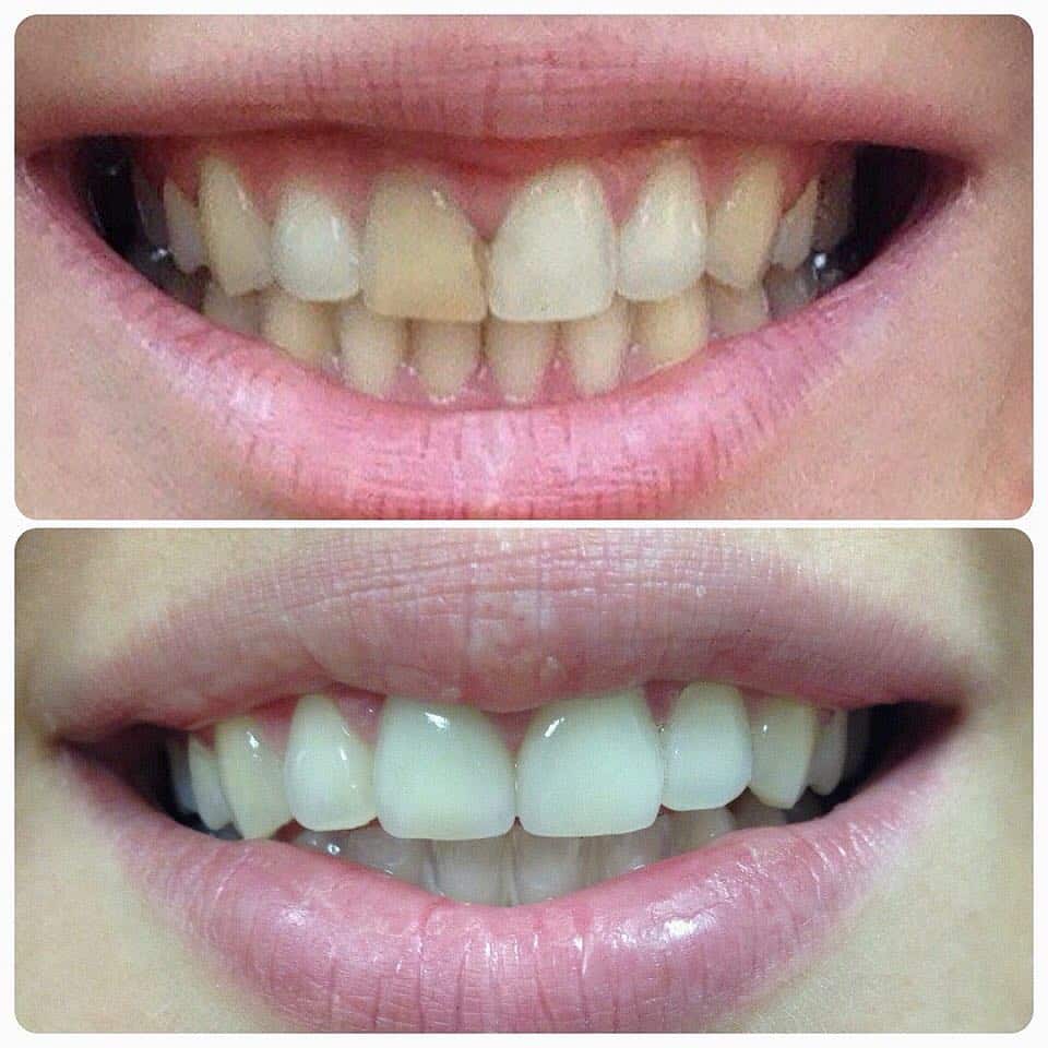 uvbrite ultracleanse review