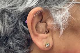 Oricle Hearing Aid reviews 1