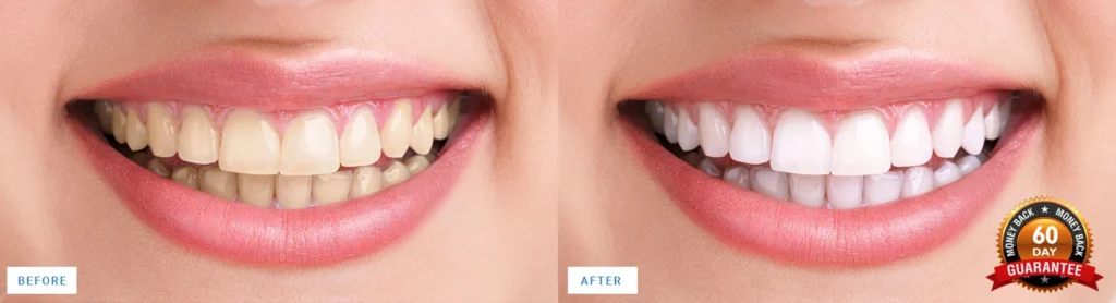 before after