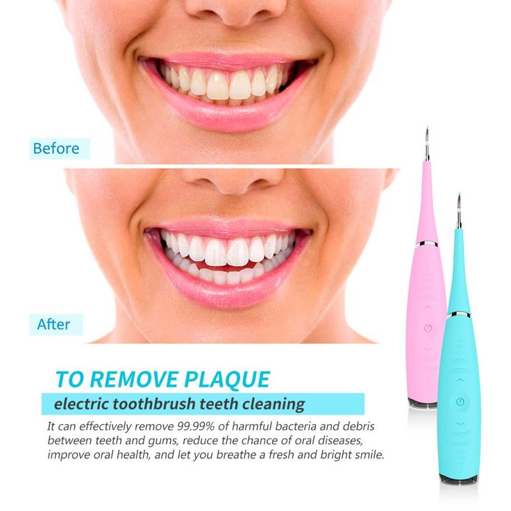 Denta Blast Ultrasonic Tooth Scraper Reviews2
