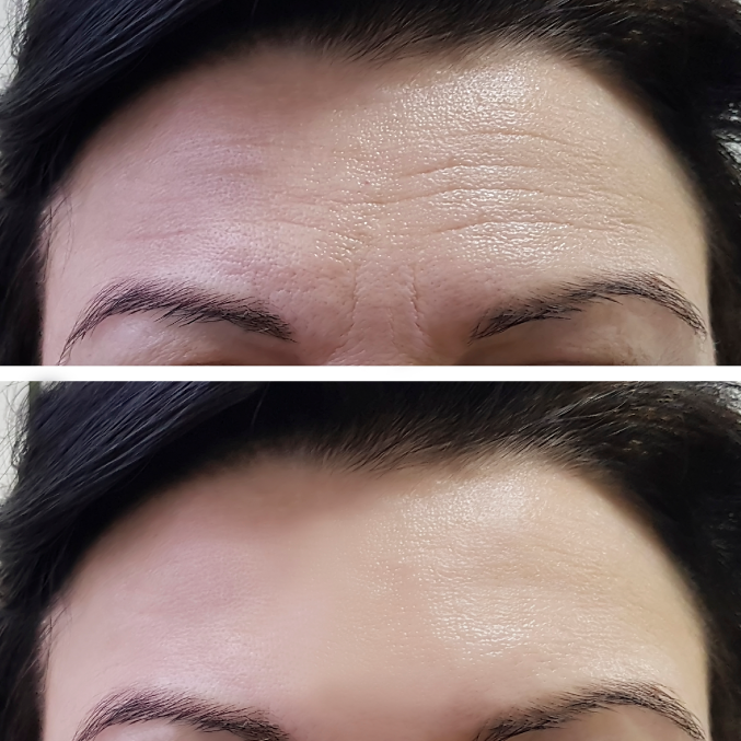 Derma Pulse reviews 3
