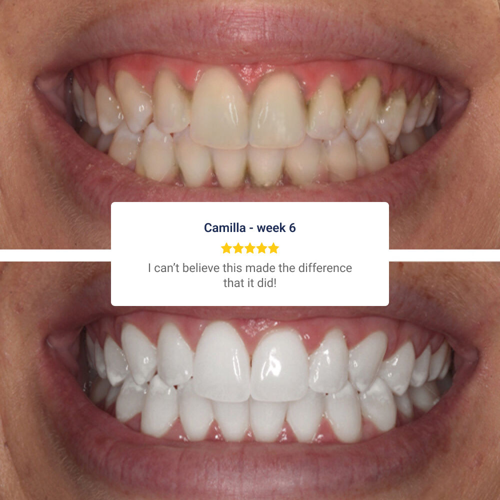 WellaWhite reviews 5