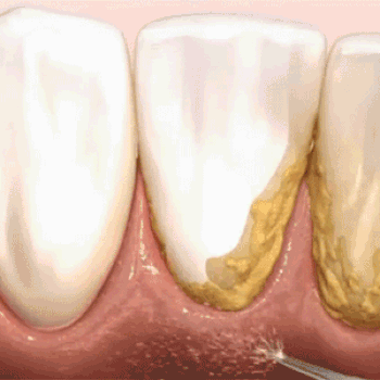 Orthopik Reviews2