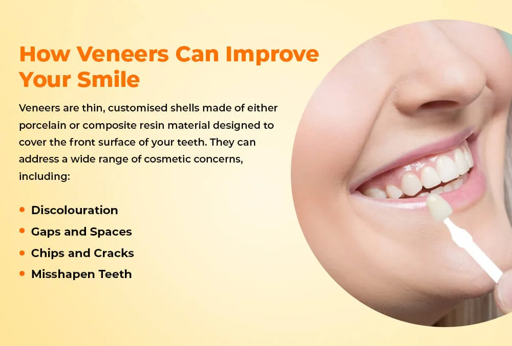 Shiny Smile Veneers reviews 5