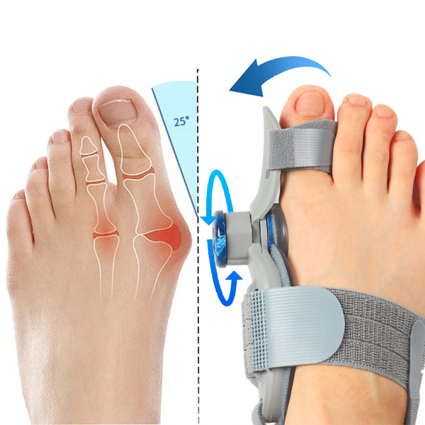 BuniCure Reviews