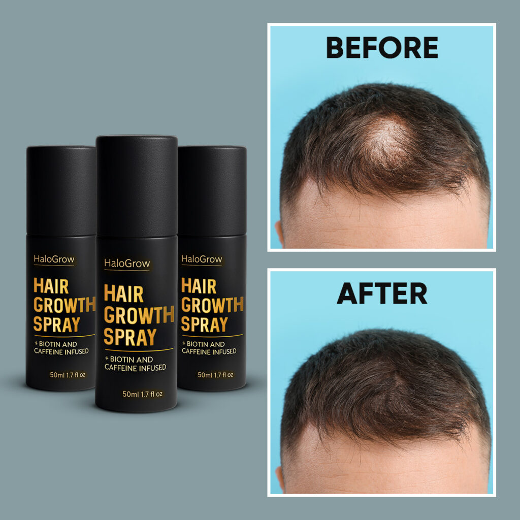 HaloGrow Hair Spray Reviews 1