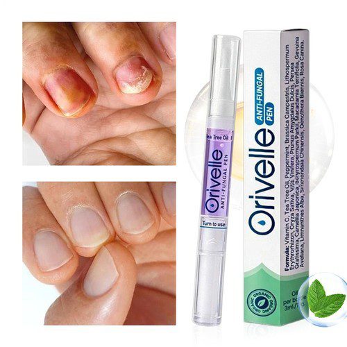 Orivelle Anti Fungal Pen Reviews