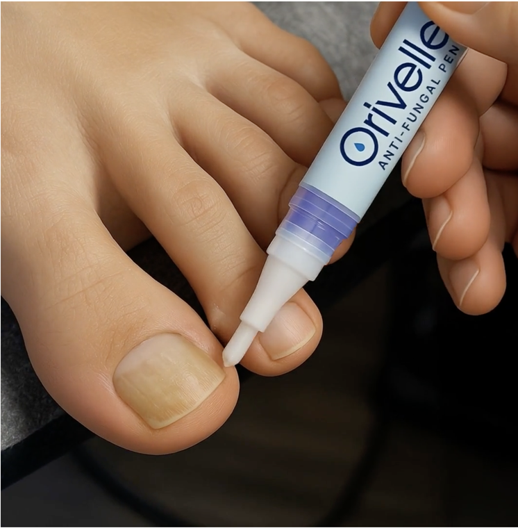 Orivelle Anti Fungal Pen Reviews