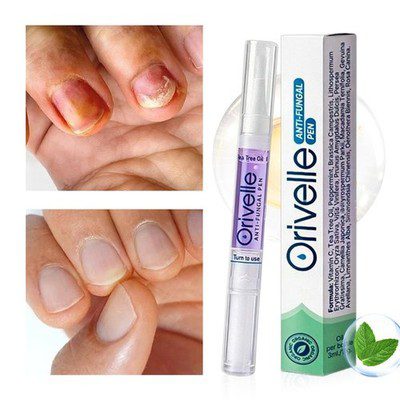 Orivelle Anti Fungal Reviews