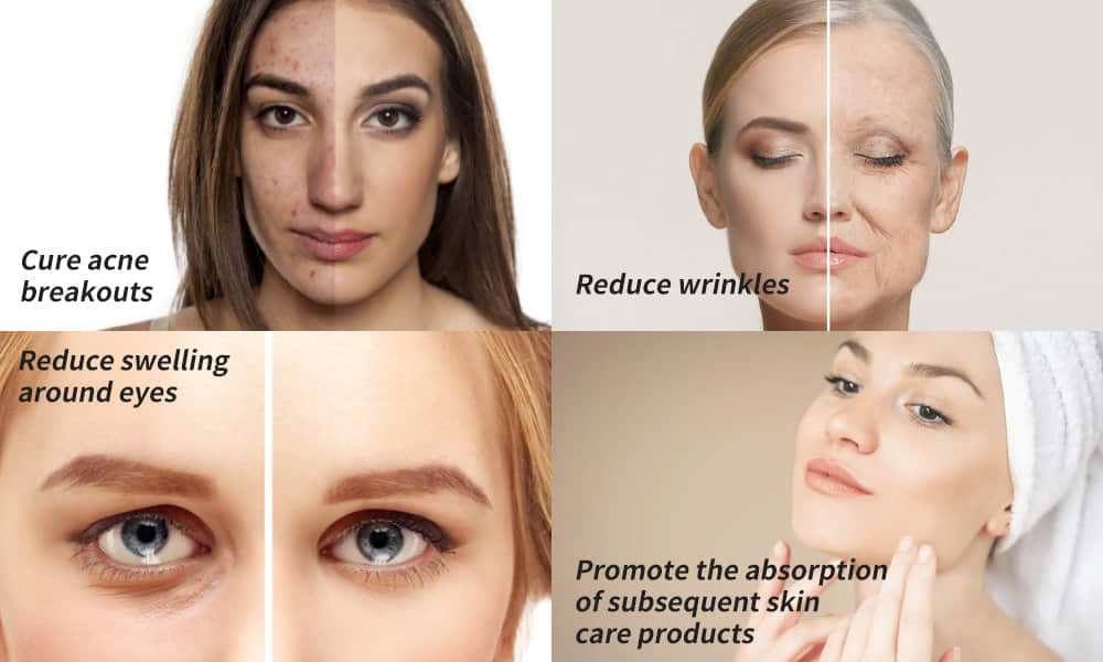 Gizmx LED Therapy Mask Reviews