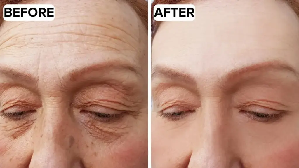 Gizmx LED Therapy Mask Reviews