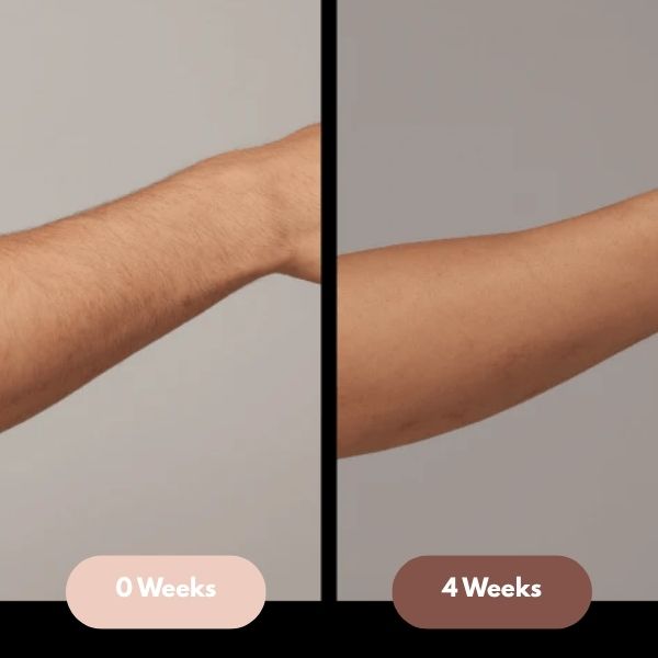 Glokore IPL Hair Remover Reviews