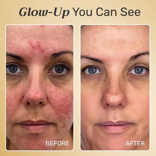 NuroDerma LED Light Mask Reviews