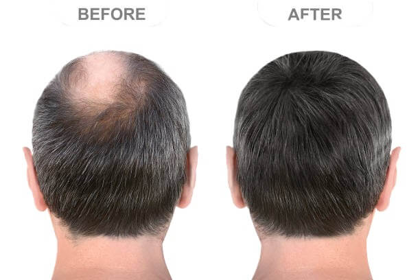 HaloGrow Hair Spray for Men Reviews