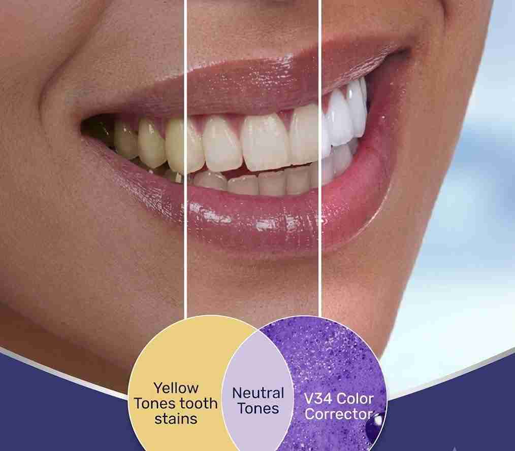 WellaWhite Teeth Whitening Foam Reviews