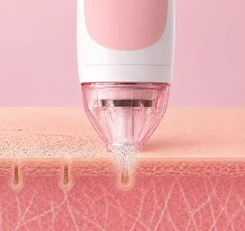 Personal Microderm Reviews