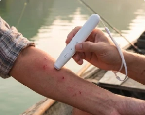 Zappify Sting Relief Pen Reviews