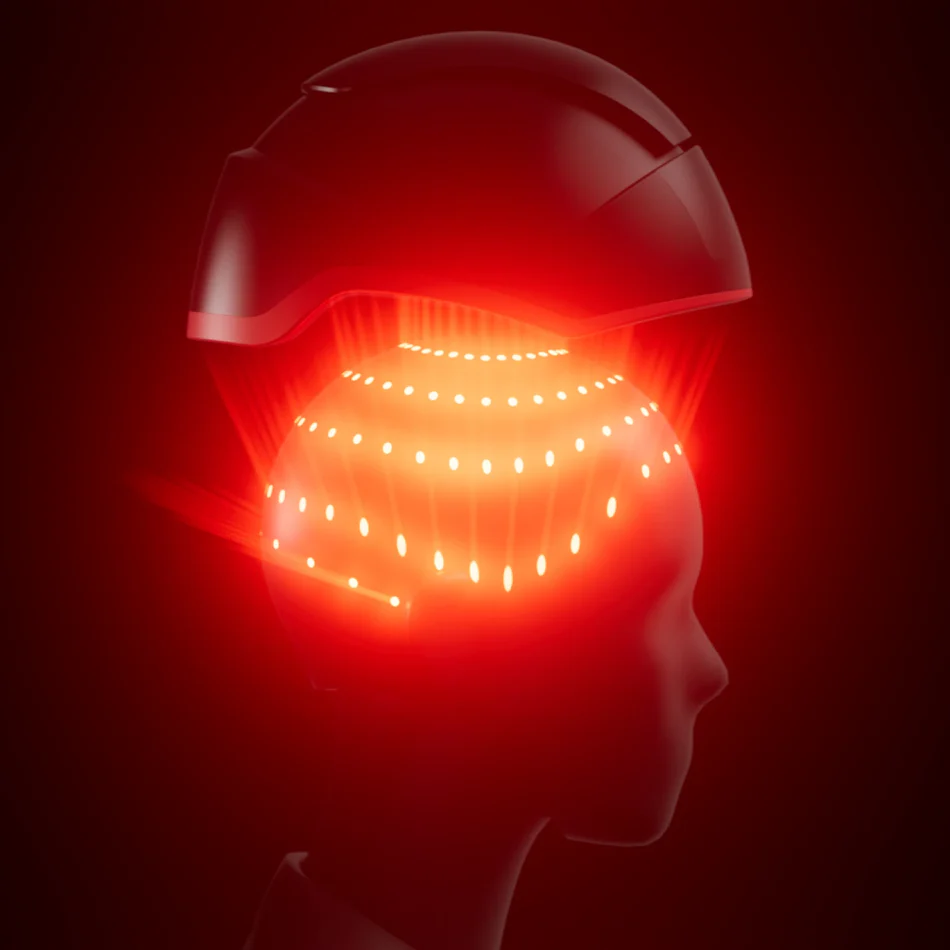 irestore elite hair growth laser reviews