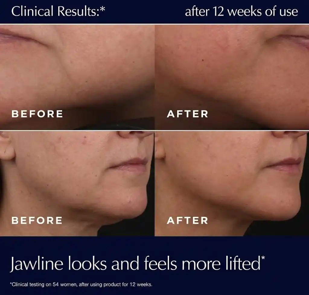 anti aging face moisturizer with hyaluronic acid