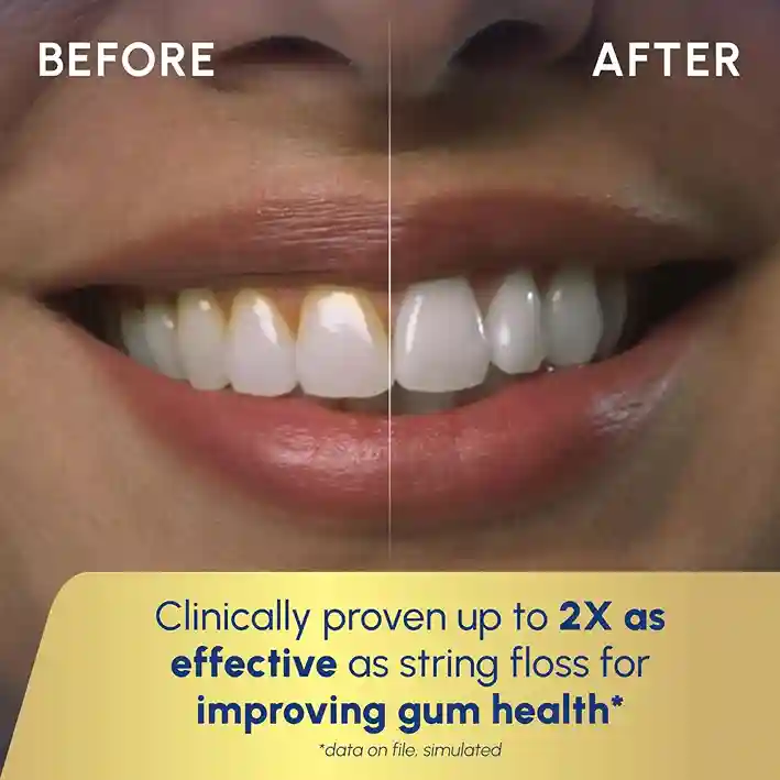 Before and after gum health with Waterpik water flosser